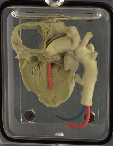 Wayne Martin Belger's .